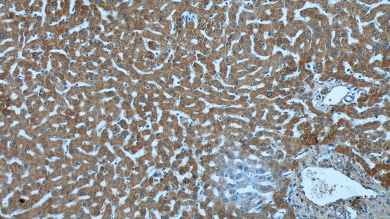 Immunohistochemistry of paraffin-embedded human liver tissue slide using Catalog No:107972(ALDH5A1 Antibody) at dilution of 1:50 (under 10x lens)
