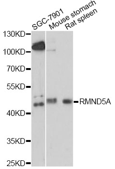 Western blot - RMND5A Polyclonal Antibody 