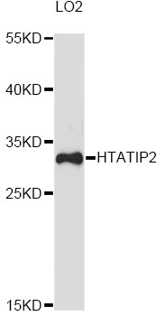Western blot - HTATIP2 Polyclonal Antibody 