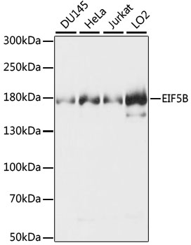 Western blot - EIF5B Polyclonal Antibody 