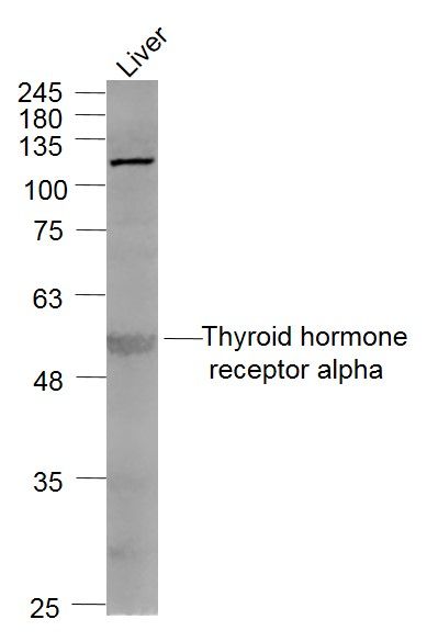 Fig4: Sample:; Liver (Mouse) Lysate at 40 ug; Primary: Anti- Thyroid hormone receptor alpha at 1/1000 dilution; Secondary: IRDye800CW Goat Anti-Rabbit IgG at 1/20000 dilution; Predicted band size: 55 kD; Observed band size: 55 kD
