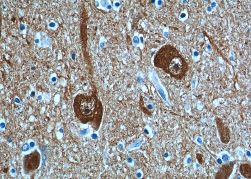 Immunohistochemistry of paraffin-embedded human hypothalamus tissue slide using Catalog No:107531(UCHL1 Antibody) at dilution of 1:500 (under 40x lens).