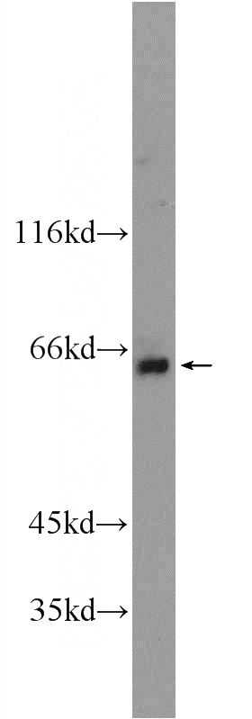 mouse testis tissue were subjected to SDS PAGE followed by western blot with Catalog No:108536(BTBD16 Antibody) at dilution of 1:300