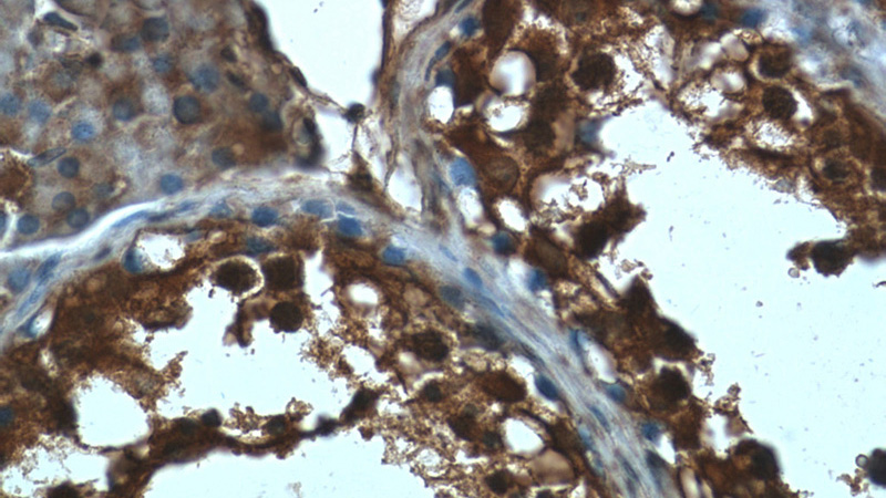 Immunohistochemistry of paraffin-embedded human testis tissue slide using Catalog No:109650(CXorf26 Antibody) at dilution of 1:50 (under 40x lens)