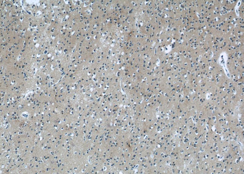 Immunohistochemistry of paraffin-embedded human brain tissue slide using Catalog No:112597(MGC39372 Antibody) at dilution of 1:50 (under 10x lens)