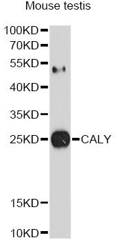 Western blot - CALY Polyclonal Antibody 