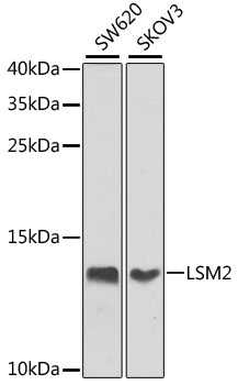 Western blot - LSM2 Polyclonal Antibody 