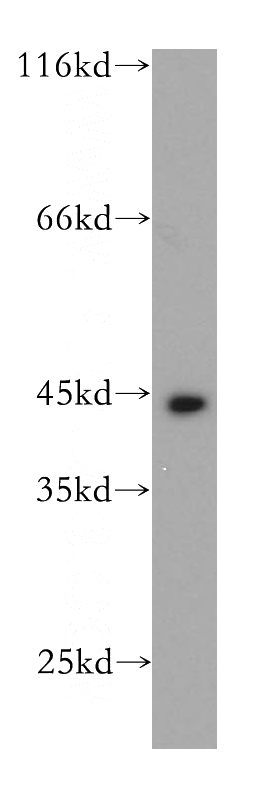 A431 cells were subjected to SDS PAGE followed by western blot with Catalog No:109802(KRT19 antibody) at dilution of 1:1500