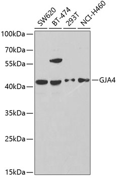 Western blot - GJA4 Polyclonal Antibody 