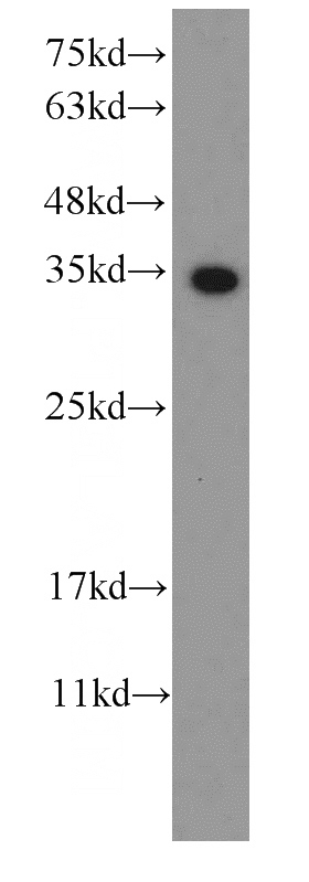 Recombinant protein were subjected to SDS PAGE followed by western blot with Catalog No:117337(S1 tag Antibody) at dilution of 1:10000