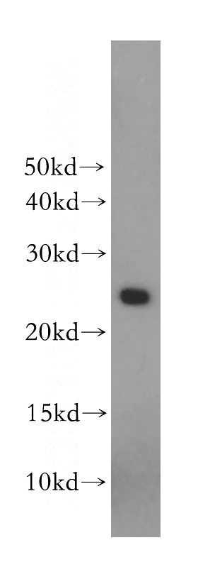 human placenta tissue were subjected to SDS PAGE followed by western blot with Catalog No:113934(CSH1 antibody) at dilution of 1:500