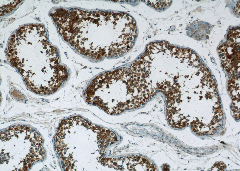 Immunohistochemistry of paraffin-embedded human testis tissue slide using Catalog No:114743(RNF151 Antibody) at dilution of 1:50 (under 10x lens)