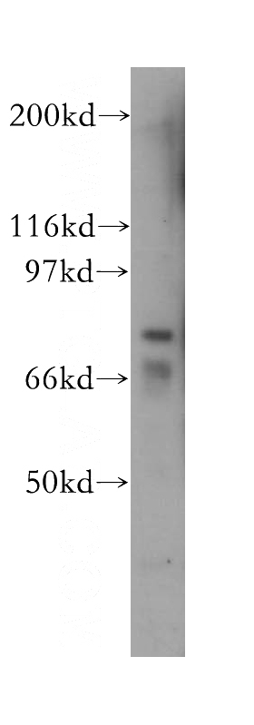 MCF7 cells were subjected to SDS PAGE followed by western blot with Catalog No:107661(ALOX15B antibody) at dilution of 1:600