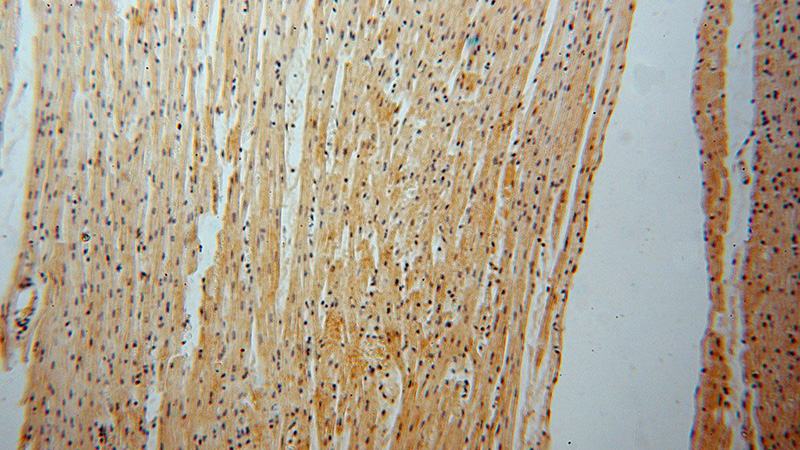Immunohistochemical of paraffin-embedded human heart using Catalog No:110096(DNAJB5 antibody) at dilution of 1:50 (under 10x lens)