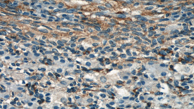 Immunohistochemical of paraffin-embedded human ovary using Catalog No:115115(SEPT11 antibody) at dilution of 1:50 (under 40x lens)