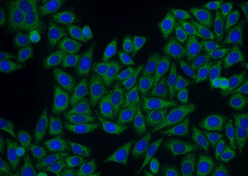 Immunofluorescent analysis of HepG2 cells using Catalog No:115058(SAMSN1 Antibody) at dilution of 1:50 and Alexa Fluor 488-congugated AffiniPure Goat Anti-Rabbit IgG(H+L)