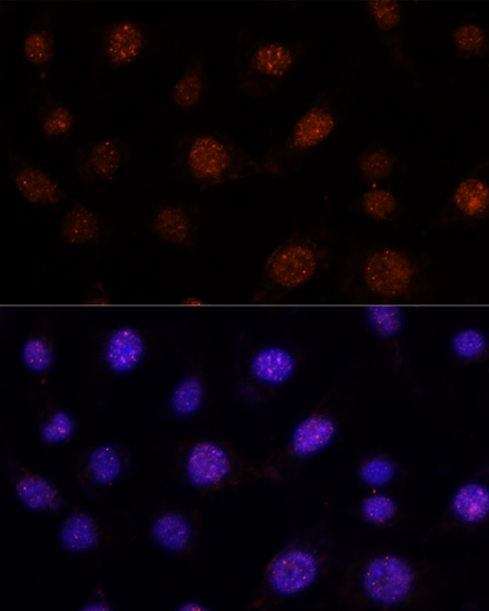 Immunofluorescence - GLI2 Polyclonal Antibody 