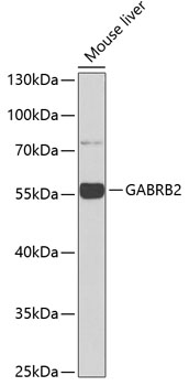 Western blot - GABRB2 Polyclonal Antibody 