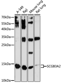 Western blot - SCGB3A2 Polyclonal Antibody 