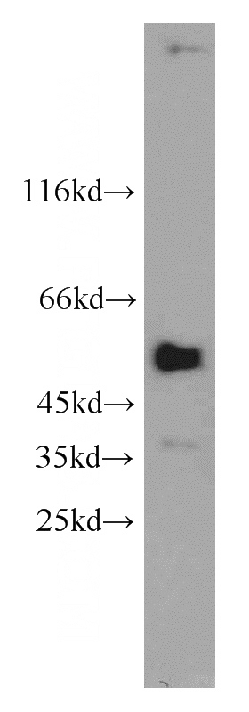 A549 cells were subjected to SDS PAGE followed by western blot with Catalog No:114117(PPP4R2 antibody) at dilution of 1:1000