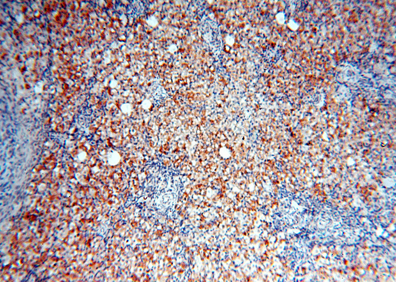 Immunohistochemical of paraffin-embedded human ovary using Catalog No:116461(TYW1B antibody) at dilution of 1:50 (under 10x lens)