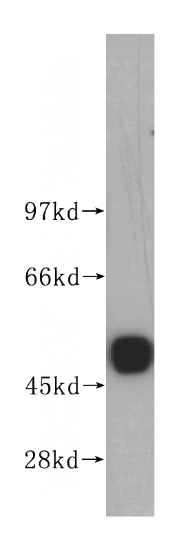 mouse brain tissue were subjected to SDS PAGE followed by western blot with Catalog No:116636(UQCRC2 antibody) at dilution of 1:500