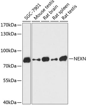 Western blot - NEXN Polyclonal Antibody 
