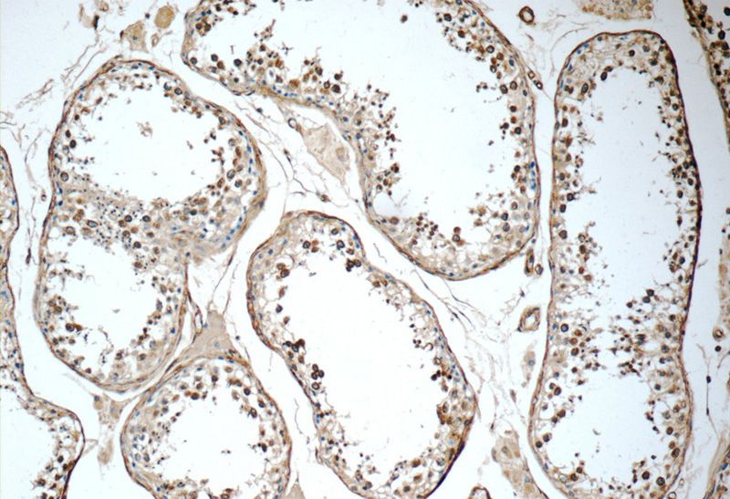 Immunohistochemistry of paraffin-embedded human testis tissue slide using Catalog No:112049(KIF5C Antibody) at dilution of 1:50 (under 10x lens)