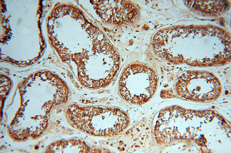 Immunohistochemical of paraffin-embedded human testis using Catalog No:108311(ATP6V1E1 antibody) at dilution of 1:100 (under 10x lens)