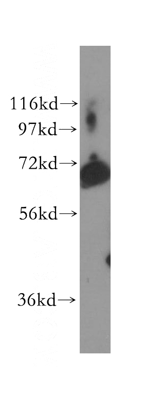 human bladder tissue were subjected to SDS PAGE followed by western blot with Catalog No:113992(POF1B antibody) at dilution of 1:500