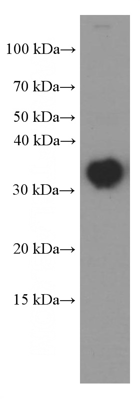 pig brain tissue were subjected to SDS PAGE followed by western blot with (CLTB Antibody) at dilution of 1:2000