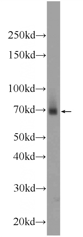 mouse small intestine tissue were subjected to SDS PAGE followed by western blot with Catalog No:117001(ZNF512 Antibody) at dilution of 1:600