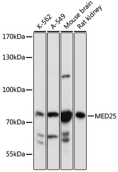 Western blot - MED25 Polyclonal Antibody 