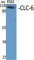 Fig1:; Western Blot analysis of various cells using CLC-6 Polyclonal Antibody diluted at 1: 500