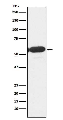 Western blot analysis of PFKFB3 expression in Jurkat cell lysate.