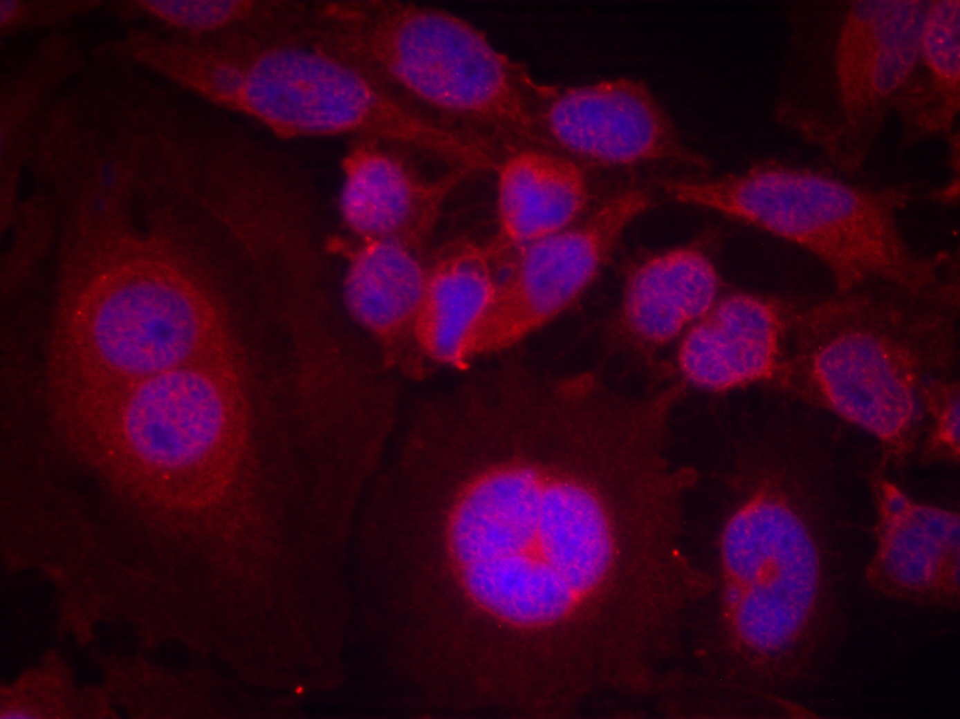 Immunofluorescence staining of methanol-fixed Hela cells using STAT3 (Phospho-Ser727) Antibody .