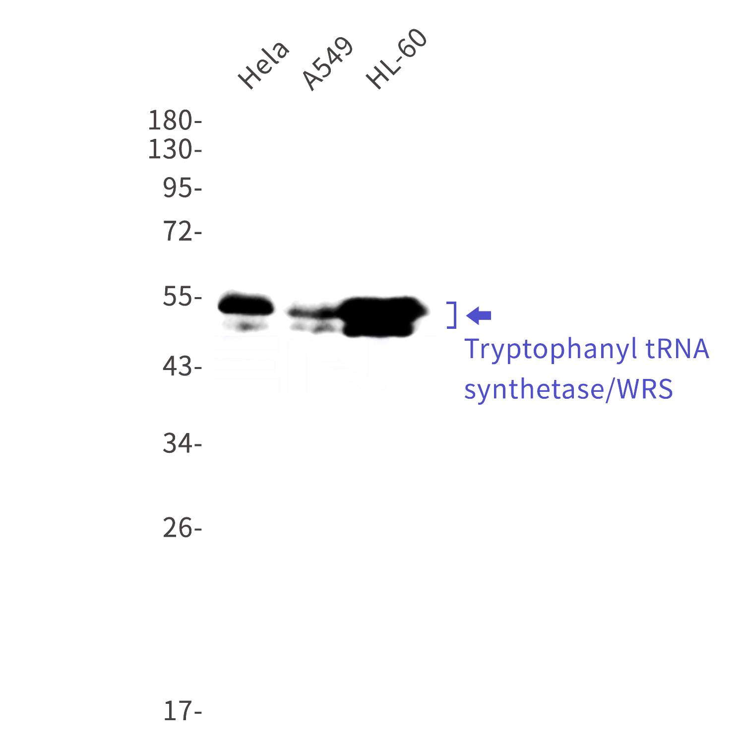 Western blot detection of Tryptophanyl tRNA synthetase/WRS in Hela,A549,HL-60 cell lysates using Tryptophanyl tRNA synthetase/WRS Rabbit mAb(1:1000 diluted).Predicted band size:53kDa.Observed band size:53kDa.