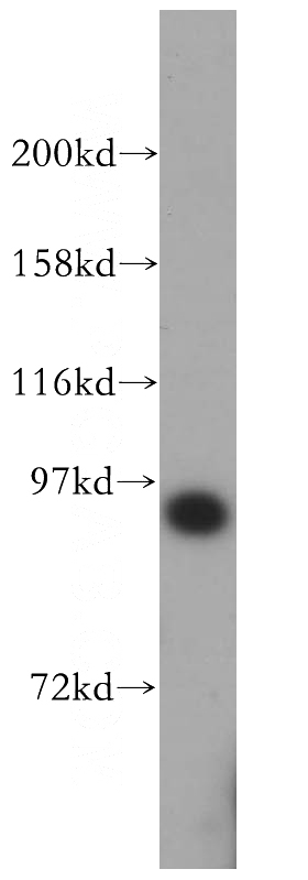 Jurkat cells were subjected to SDS PAGE followed by western blot with Catalog No:115596(SRPK1 antibody) at dilution of 1:1000
