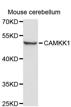 Western blot - CAMKK1 Polyclonal Antibody 