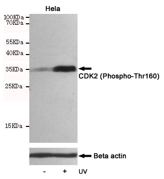 Western blot analysis of extracts from Hela cells, untreated or treated with UV, using CDK2 (Phospho-Thr160) Rabbit pAb (167125,1:500 diluted,upper) or Beta actin Mouse mAb (200068-8F10,lower).