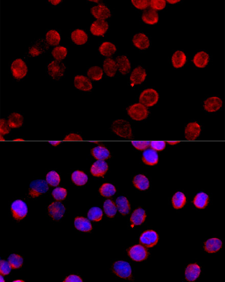 Immunofluorescence - CYP11B2 Polyclonal Antibody 