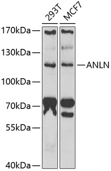 Western blot - ANLN Polyclonal Antibody 