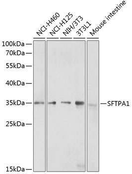 Western blot - SFTPA1 Polyclonal Antibody 