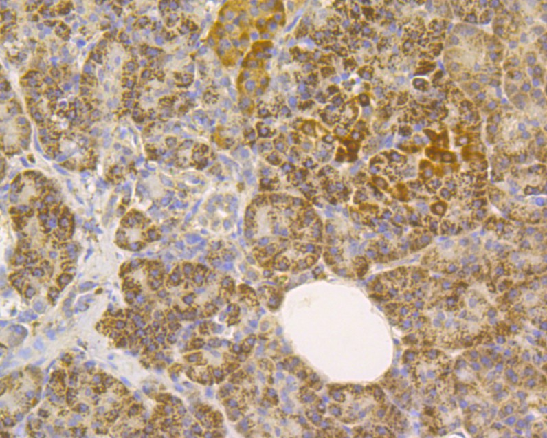 Fig6:; Immunohistochemical analysis of paraffin-embedded human pancreas tissue using anti-SLC8B1 antibody. The section was pre-treated using heat mediated antigen retrieval with Tris-EDTA buffer (pH 8.0-8.4) for 20 minutes.The tissues were blocked in 5% BSA for 30 minutes at room temperature, washed with ddH; 2; O and PBS, and then probed with the primary antibody ( 1/100) for 30 minutes at room temperature. The detection was performed using an HRP conjugated compact polymer system. DAB was used as the chromogen. Tissues were counterstained with hematoxylin and mounted with DPX.