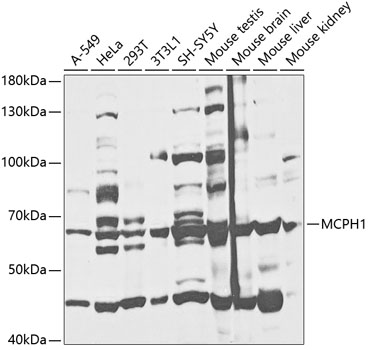 Western blot - MCPH1 Polyclonal Antibody 