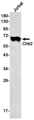 Western blot detection of Chk2 in Jurkat cell lysates using Chk2 Rabbit mAb(1:500 diluted).Predicted band size:61kDa.Observed band size:61kDa.