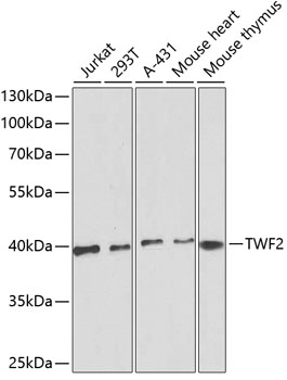 Western blot - TWF2 Polyclonal Antibody 