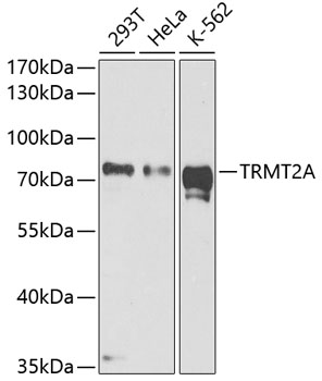 Western blot - TRMT2A Polyclonal Antibody 