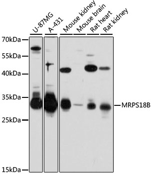 Western blot - MRPS18B Polyclonal Antibody 