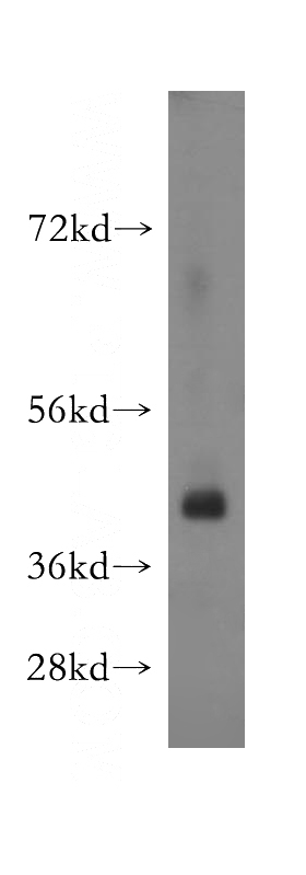 human testis tissue were subjected to SDS PAGE followed by western blot with Catalog No:115552(SPATA22 antibody) at dilution of 1:500